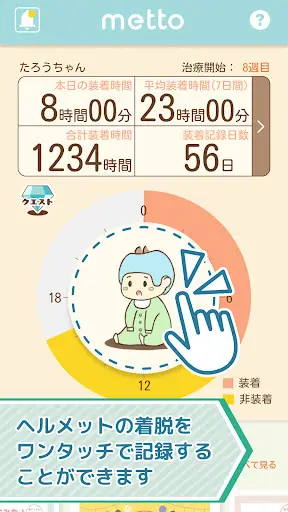ヘルメット治療支援アプリ metto — 3