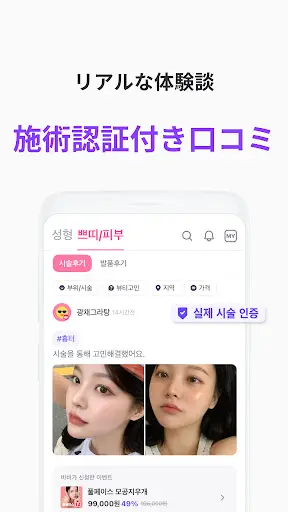 バビトーク − 韓国 整形 / 施術プラットフォーム — 2